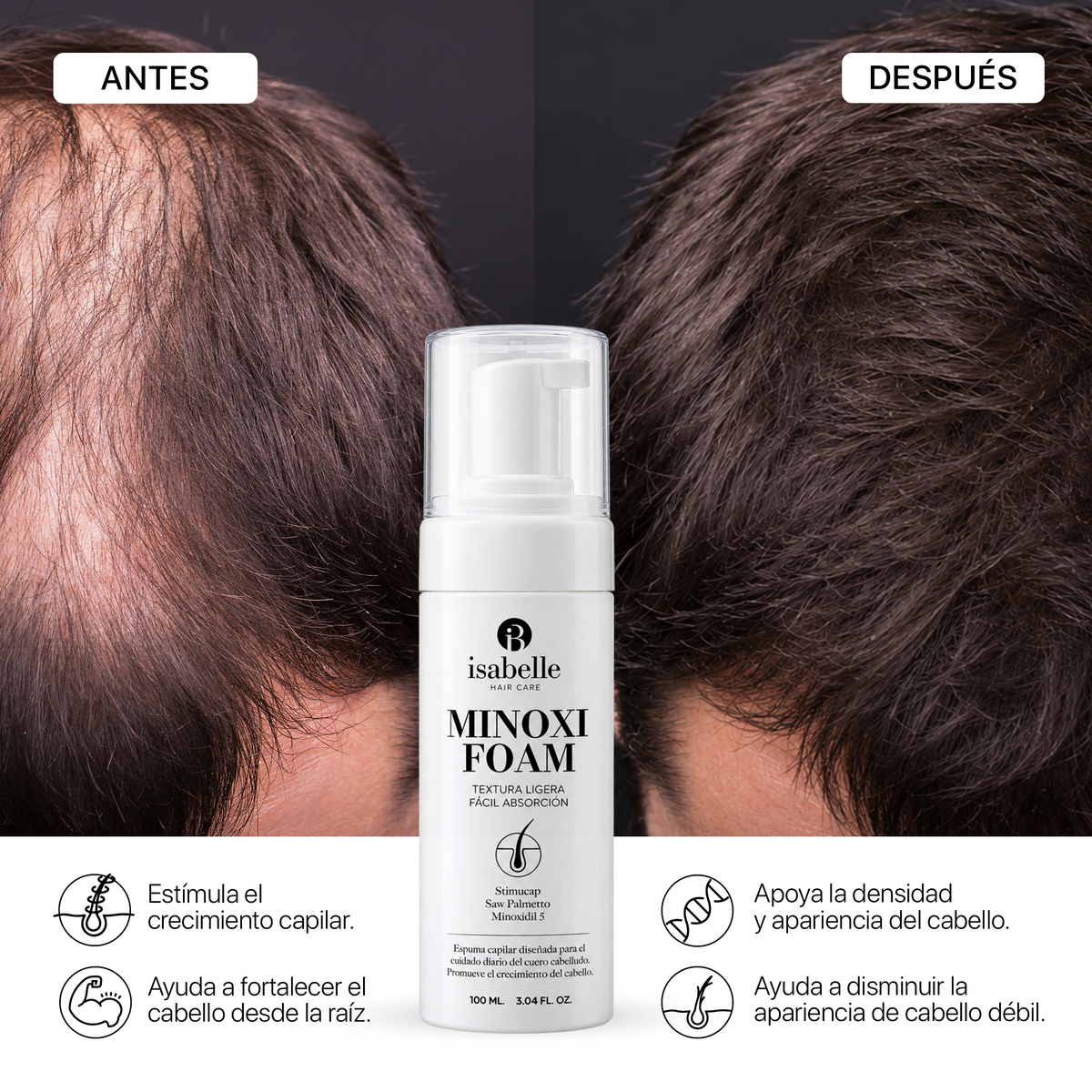 Minoxi Foam antes y después